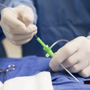 How Minimally Invasive Surgeries Are Becoming Popular?